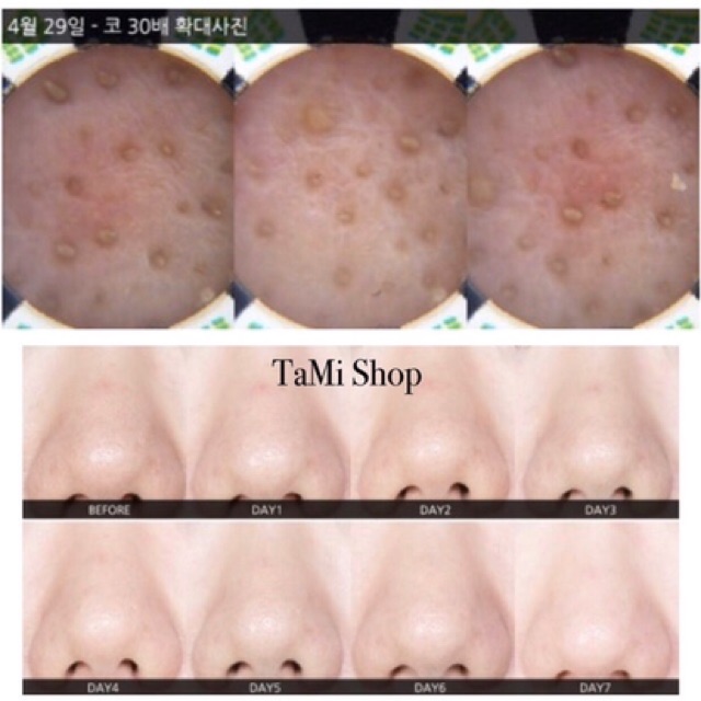 Thanh lăn mụn đầu đen Mamonde Pore Clean Blackhead stick