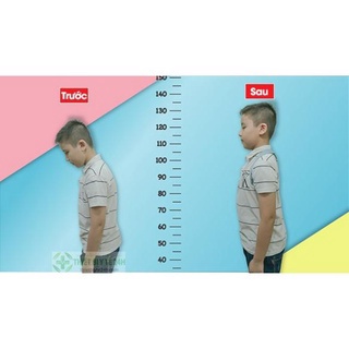 Đai Chống Gù Lưng Kyphosis