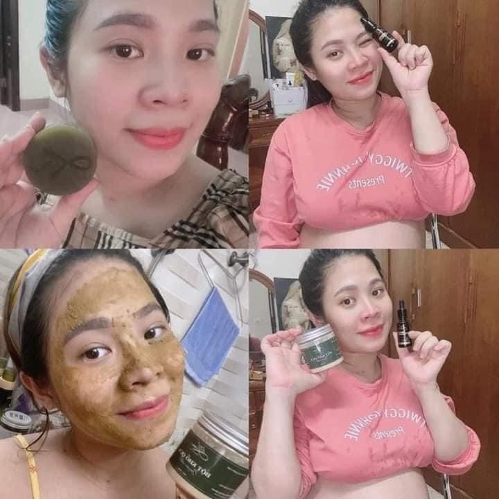 Bột Khổ qua LIM làm sạch mụn mờ thâm nám an toàn hiệu quả.