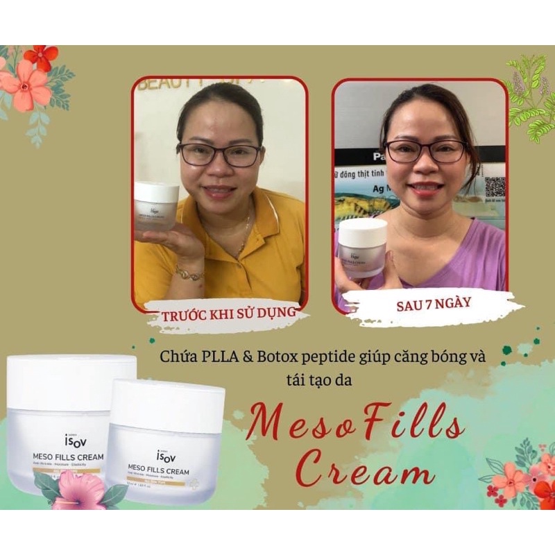 MESO FILLS CREAM - Kem Chứa PLLA & Botox Giúp Tái Tạo Và Căng Bóng Da