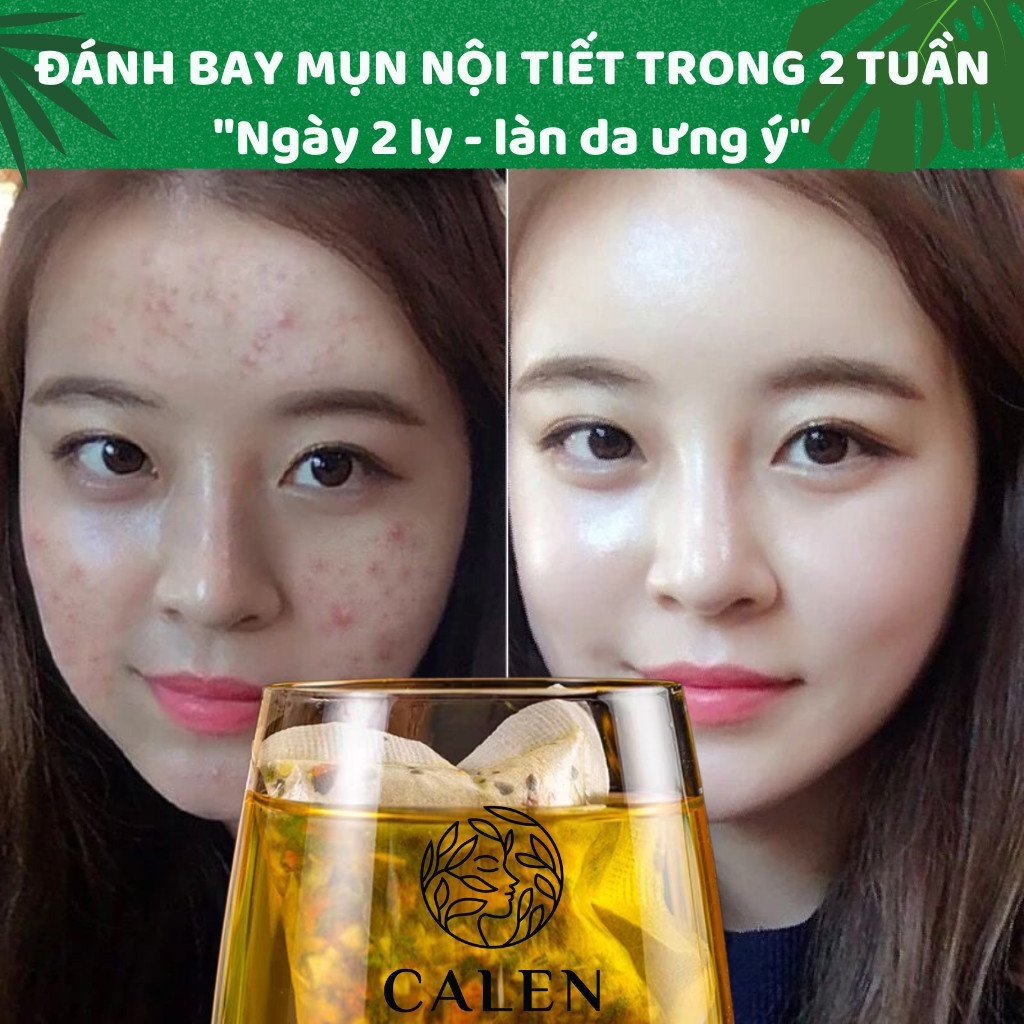 [Da mụn] Trà lá tre Calen Nature's Farm giảm nhờn mờ thâm nám, giúp ngừa mụn hiệu quả qua đường bài tiết bịch 30 gói lọc