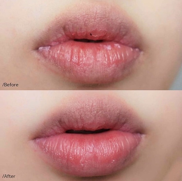 Tẩy tế bào chết môi Unpa bubi bubi lip | BigBuy360 - bigbuy360.vn