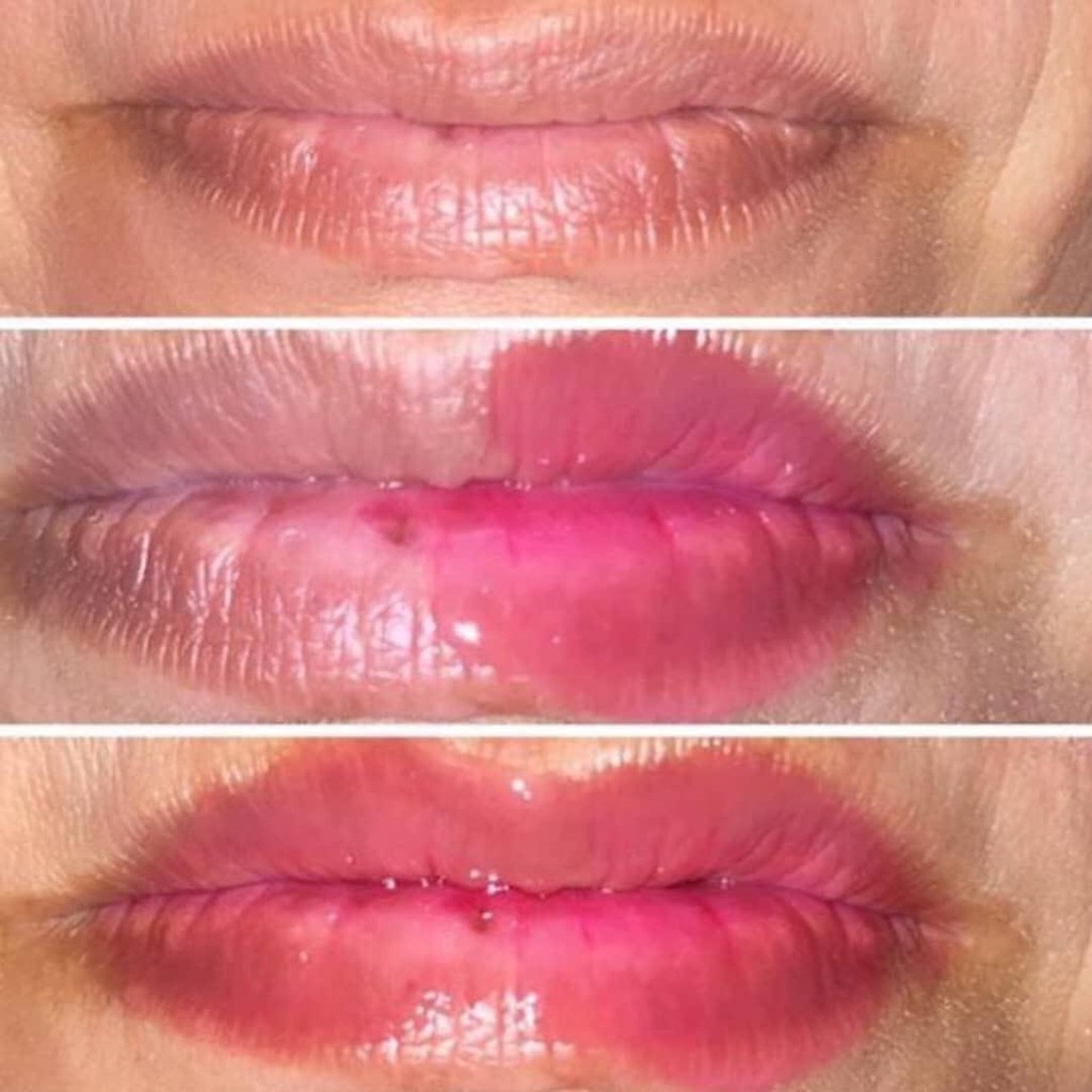 (hàng Mới Về) Serum Dưỡng Môi Lippie By Raeca | BigBuy360 - bigbuy360.vn
