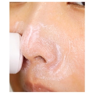 [So'natural] Thanh Lăn Mụn Đầu Đen RED PEEL