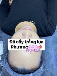 Cấy trắng spa handmade