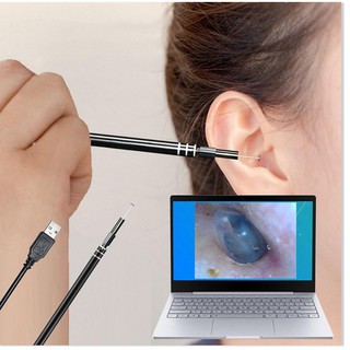 Lấy Ráy Tai Thông Minh ✔️Chính Hãng✔️ 3 trong 1 có đèn LED, Nội Soi Tai Mũi Họng, Có Kết Nối Với Điện Thoại, Máy Tính