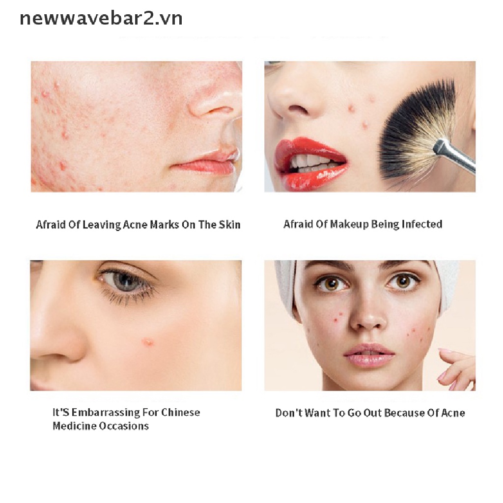 2 Miếng Dán Hỗ trợ giảm mụn Trứng Cá Và ddvn