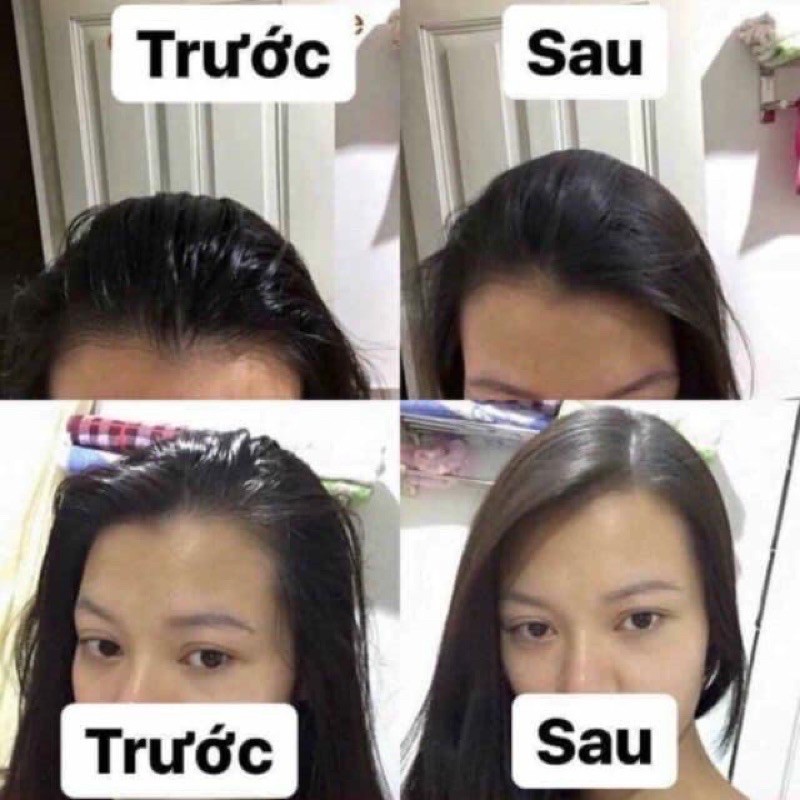 xịt gội khô ISSY