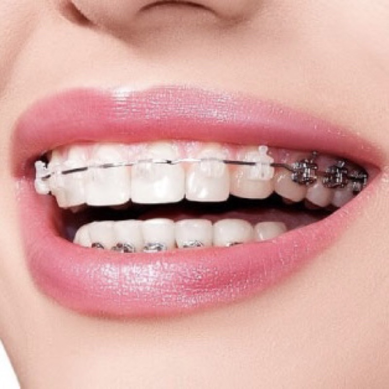 Kem đánh răng niềng răng thảo mộc Thái Lan Derrich herbal Oral làm sạch khử mùi bảo vệ răng nướu