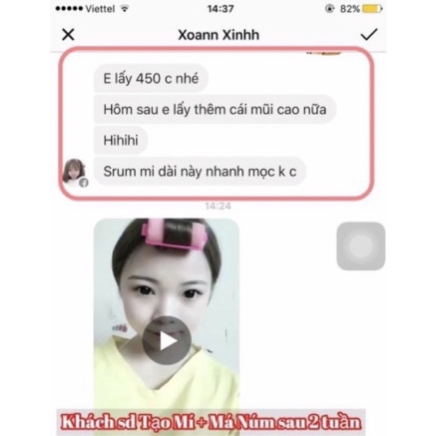 Tinh chất Miracle Pháp tạo mắt 2 mí, mở tròng mắt siêu hiệu quả (10ml)