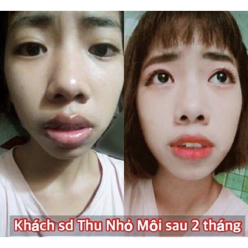 Tinh chất thu nhỏ môi Miracle, hiệu quả chỉ sau 14 ngày