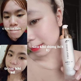 Ủ trắng kén tằm LSKIN WHITE