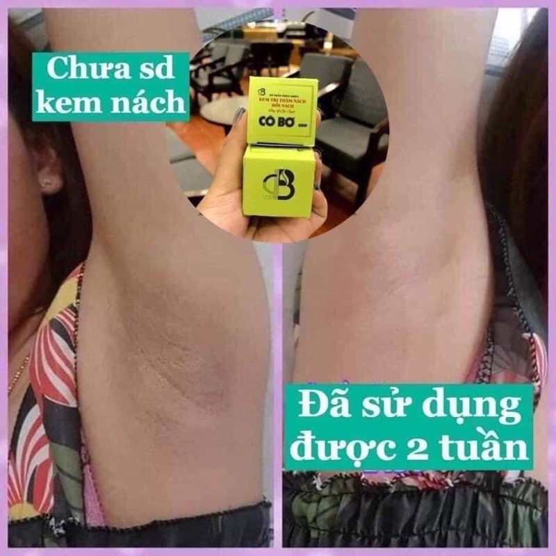 Combo 2 hộp kem khử thâm nách hôi nách Cô Bơ