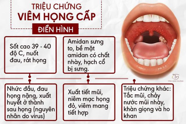 Amidan Ho Viêm Họng Hạt Cụ Làng Nghè