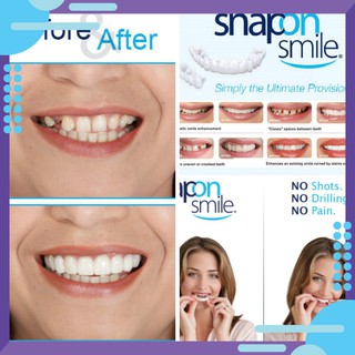 [GIÁ SỈ] RĂNG GIẢ SNAP ON SMILE [SALE]