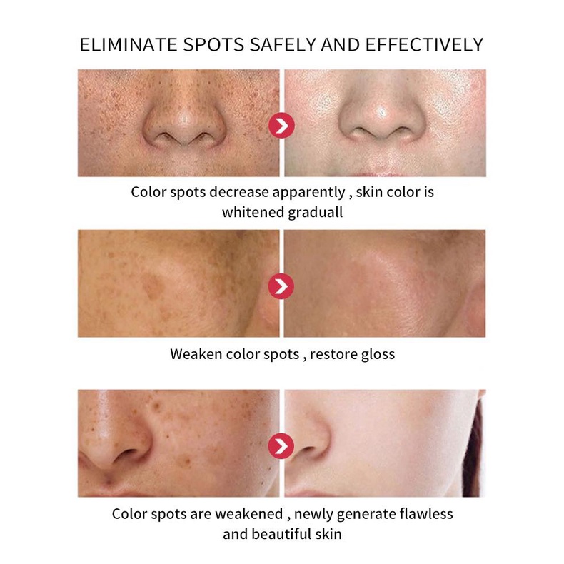 Kem dưỡng trắng ARBUTIN 5% TOSOWOONG HÀN