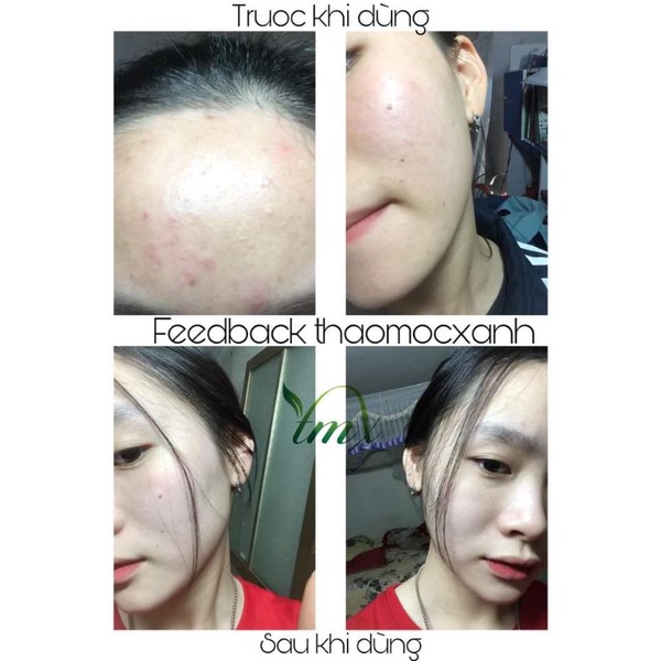 [Freeship] Thảo Mộc Xanh 5ml | BigBuy360 - bigbuy360.vn