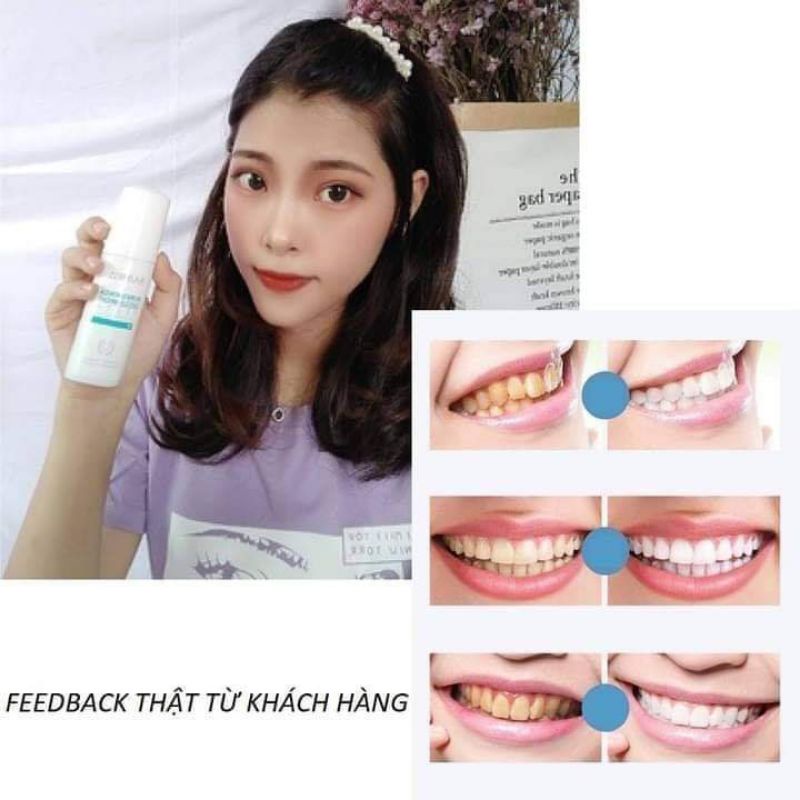 Bọt Sủi Trắng Răng Baimiss Sale Mạnh