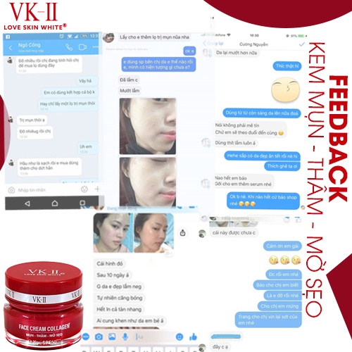Kem dưỡng da giảm mụn mờ thâm sẹo VK-II Love Skin White Face Cream Collagen 20g