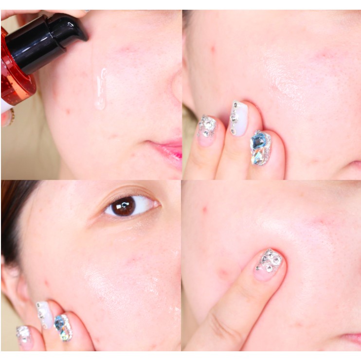 Tinh Chất Dưỡng Trắng, Phục Hồi Da, Giảm Mụn Mờ Thâm Sẹo Do Mụn Hàn Quốc Some By Mi Serum 50ml