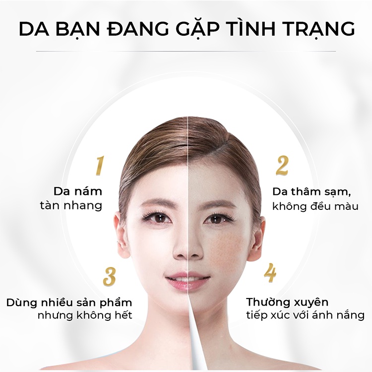 Bộ đôi kem dưỡng giảm Nám Nhỏ ORISKIN MELASMA WHITENING CREAM 6g và kem chống nắng ORISKIN UV PERFECT SUN CREAM 20ml