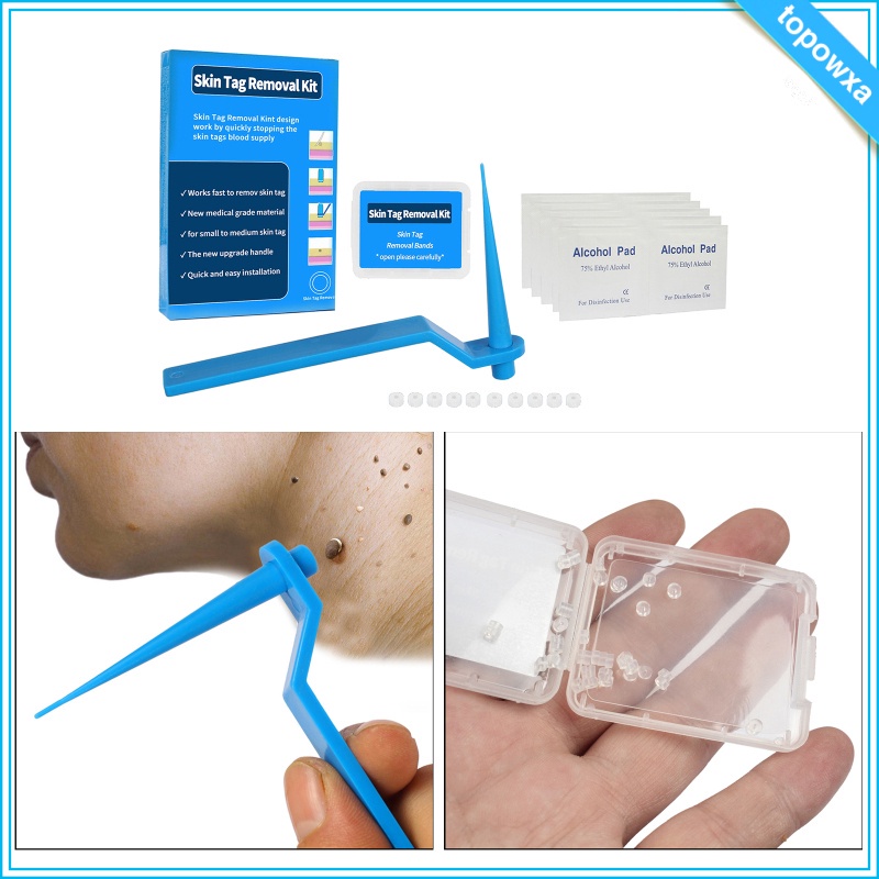 Dụng cụ loại bỏ mụn thịt trên da mặt và cổ từ 2-5mm không đau
