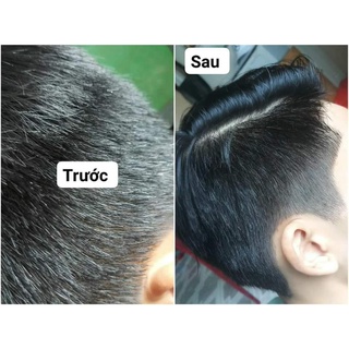 Hà thủ ô viên DVi nature