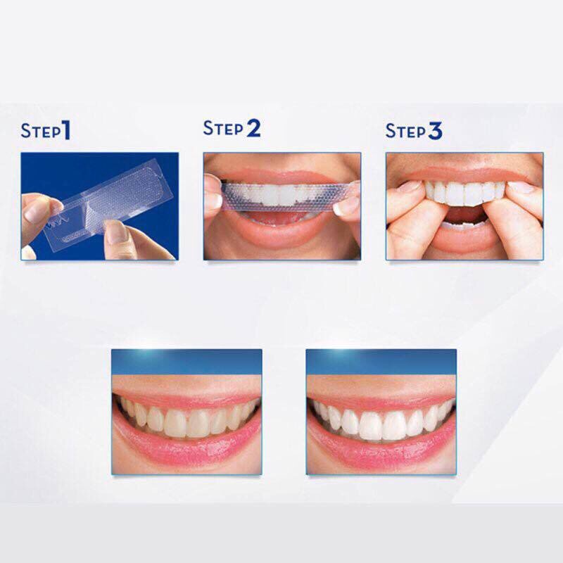 Hộp 7 Gói 14 Miếng dán trắng răng tiện lợi 3D White Teeth Whitening Strips