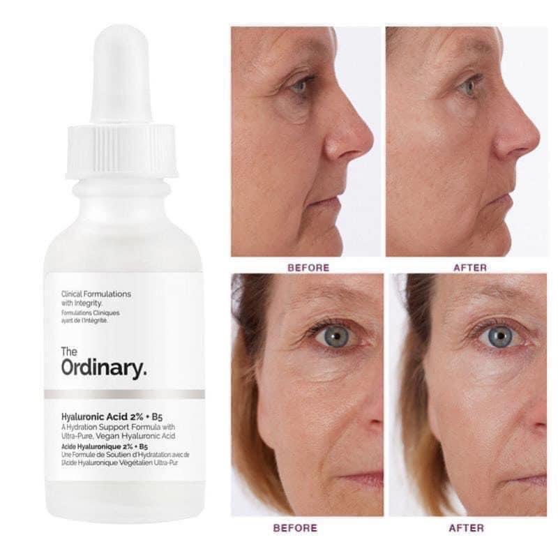 The Ordinary Hyaluronic Acid 2% + B5 phục hồi da, cấp ẩm - Serum B5 làm dịu da The Ordinary