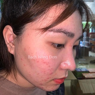 Kem dưỡng Bạch hồng đơn