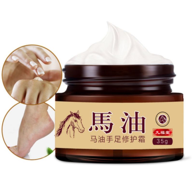 Kem dầu ngựa trị nứt gót chân chính hãng