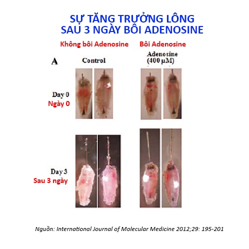 Bột Adenosine nguyên chất, nguyên liệu mỹ phẩm râu tóc bôi kèm minoxidil, giúp mọc & dày cứng râu tóc