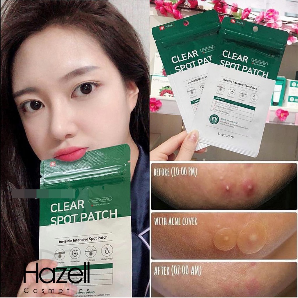 Miếng Dán Mụn Some By Mi Clear Spot Patch