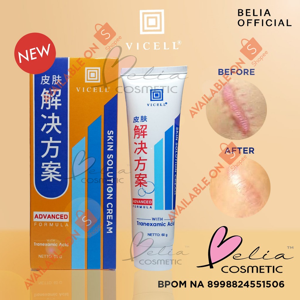 (hàng Mới Về) Kem Trị Sẹo Belia Vicell (bpom) 60ml