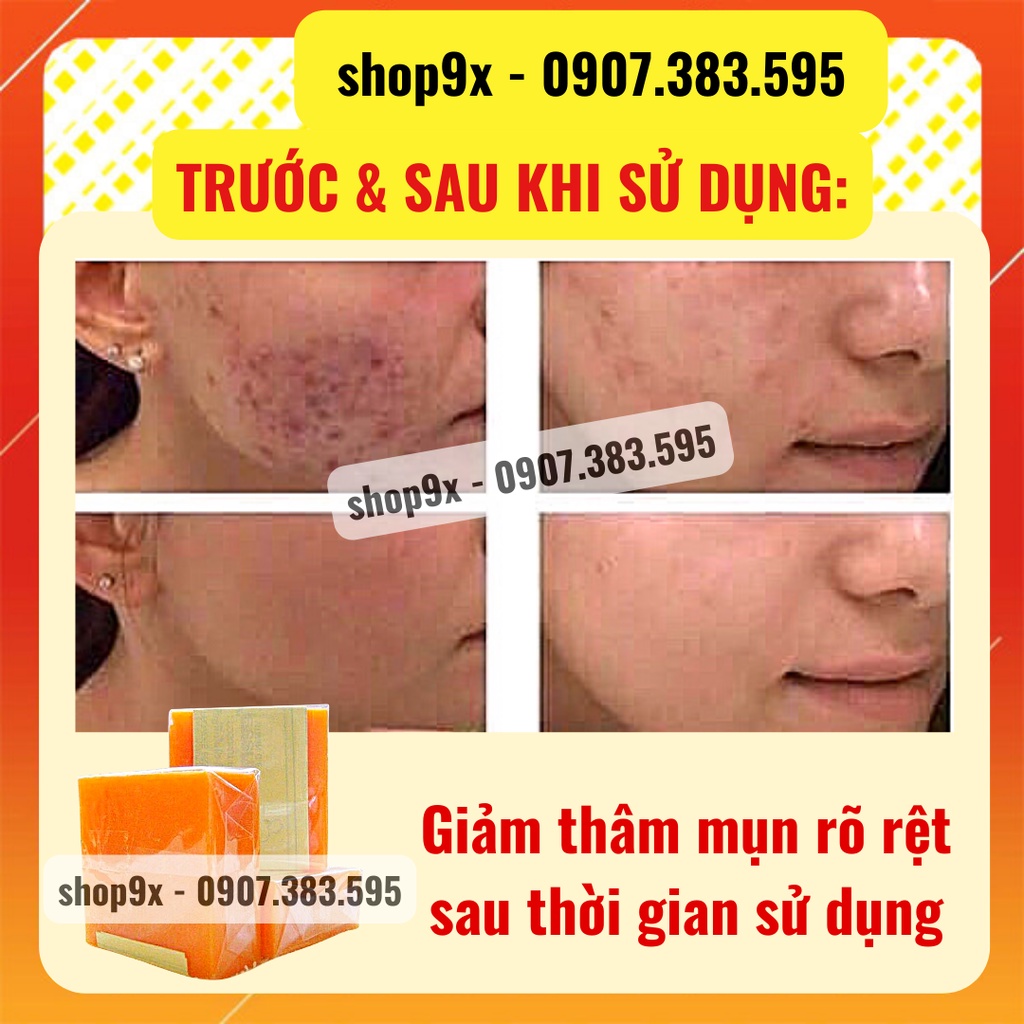 Xà Phòng Nghệ Và Cám Gạo Cao Cấp Sáng Da Ngừa Mụn Cho Mặt Và Body