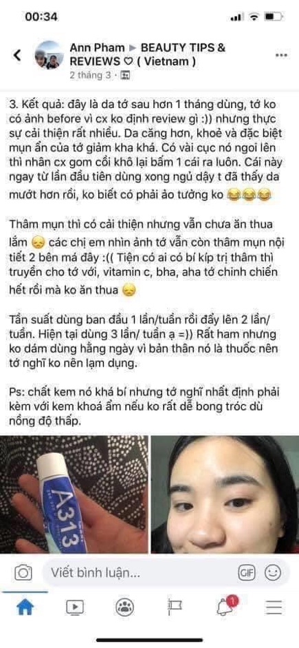 Kem Retinol A313 giảm mụn, xoá mờ vết thâm, trị nhăn và trẻ hoá da hiệu quả