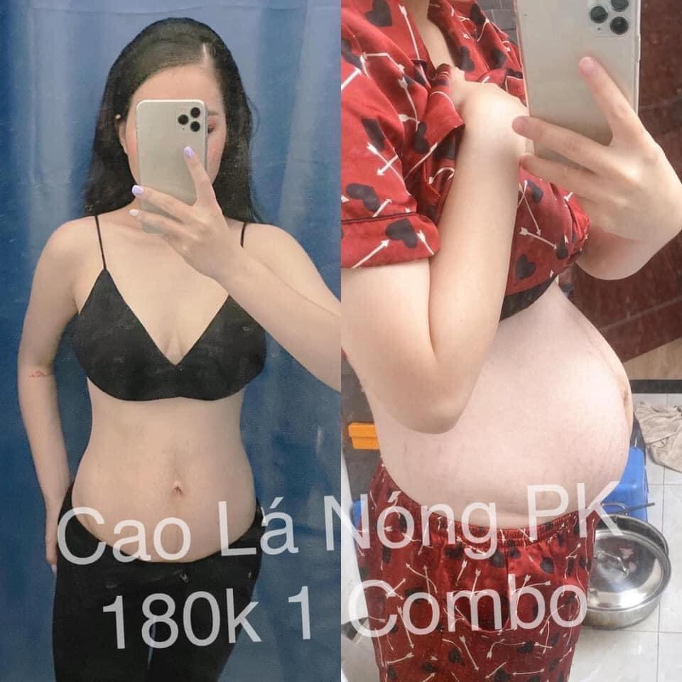 ⚡️FREE SHIP⚡️Combo Cao Lá Nóng Gia Truyền Tặng Kèm Quấn Nóng ,Giảm Cân - Tan Mỡ - Mờ Rạn