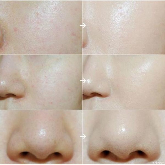 Kem dưỡng trắng da Meishoku Instawhite Tone Up Cream | BigBuy360 - bigbuy360.vn