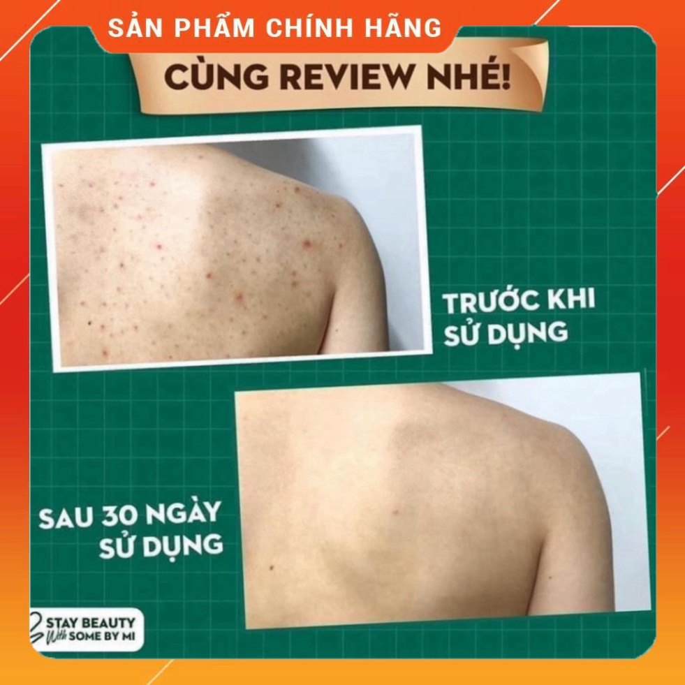 CHÍNH HÃNG-  Sữa tắm mụn lưng, body Some by mi AHA.BHA.PHA 30 Days 400g | BigBuy360 - bigbuy360.vn