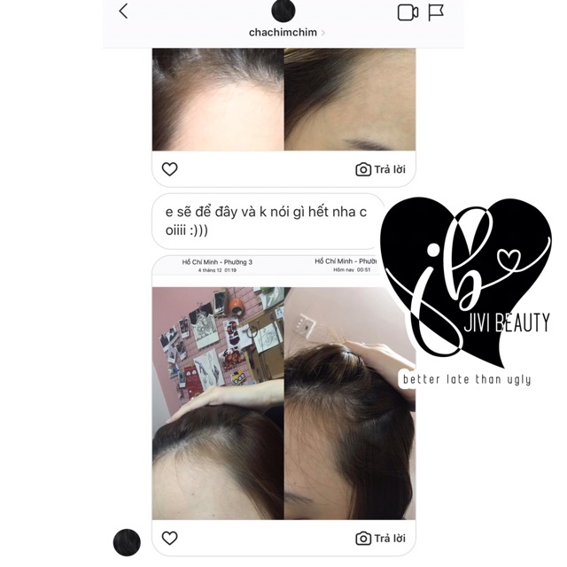 XỊT KÍCH MỌC TÓC GIẢM RỤNG | BigBuy360 - bigbuy360.vn