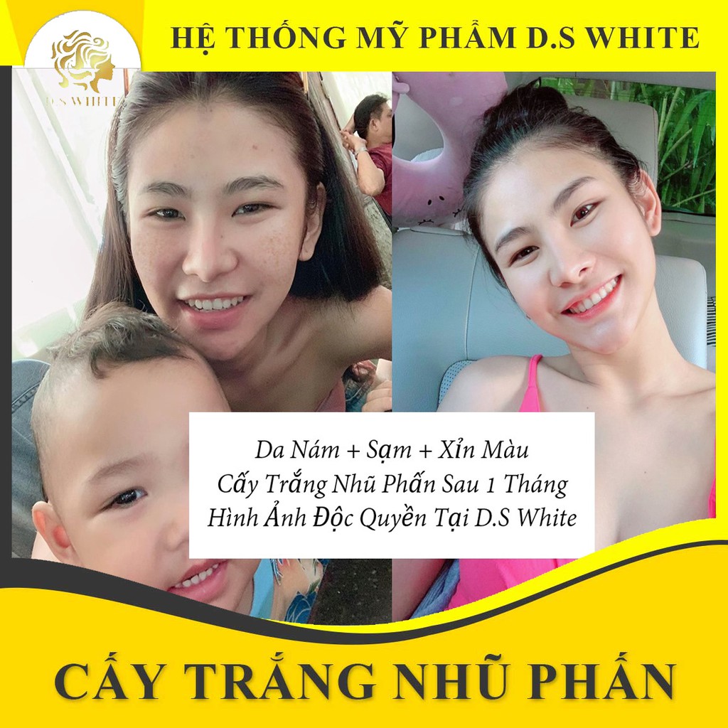 Bộ Cấy Trắng Da Mặt [Chính Hãng - DS White] - 3 Bước Làm Trắng Da Mặt Tại Nhà [Tặng máy cấy trắng ion]