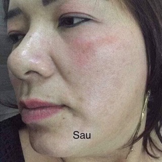 Bộ Meiya cam của Nhật