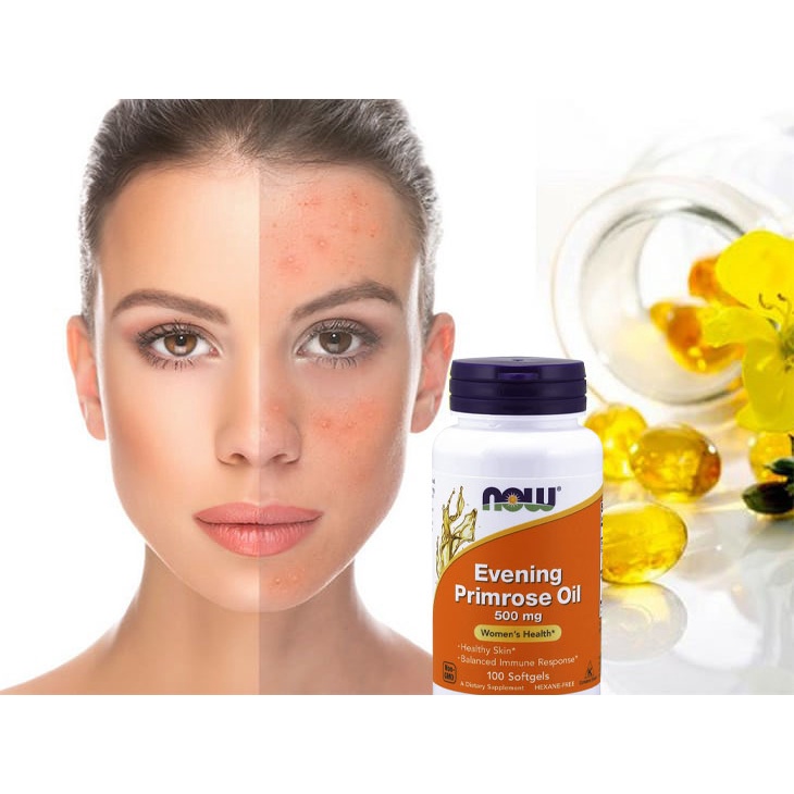 Now Evening Primrose Oil, Tinh Dầu Hoa Anh Thảo Cân Bằng Nội Tiết Tố Nữ, Đẹp Da 500MG