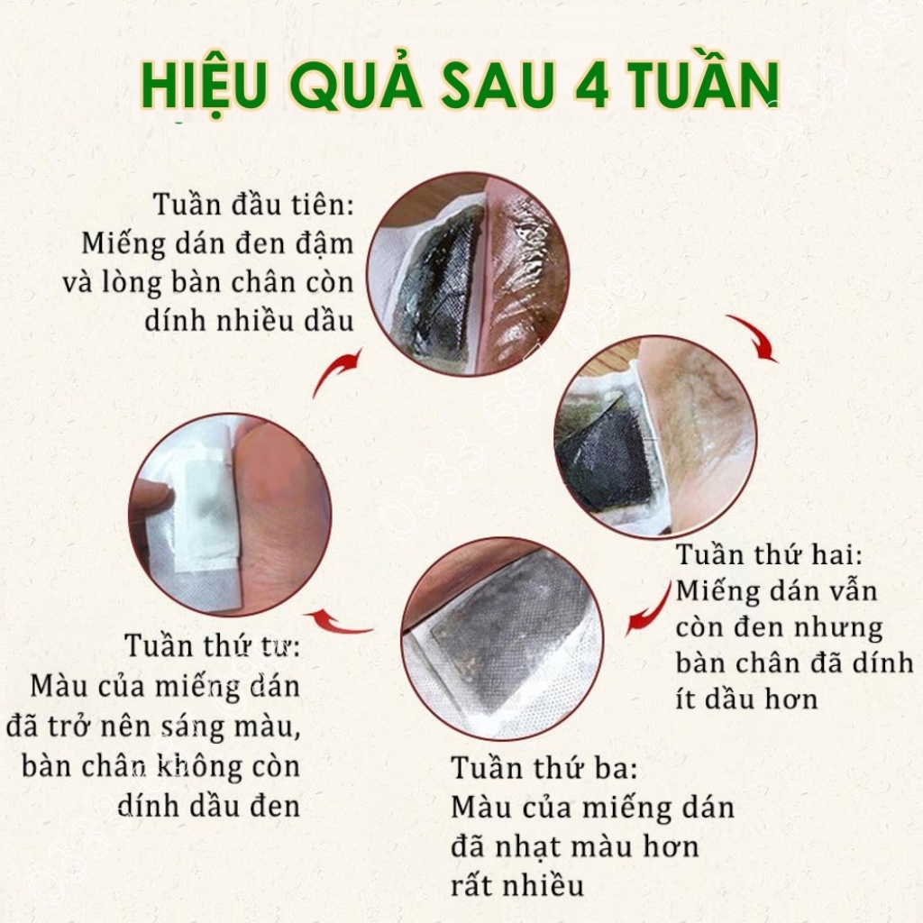 Miếng dán chân ngải cứu  cao dán thải độc bàn chân,ngủ ngon đẹp da,thúc đẩy lưu thông máu,giảm mệt mỏi