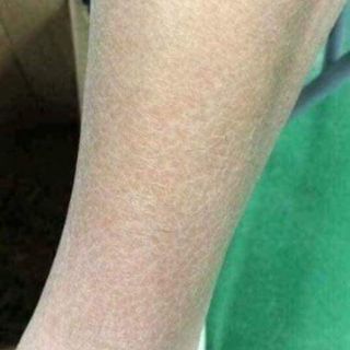 [CHÍNH HÃNG] Vaselin Kem nẻ viện bỏng