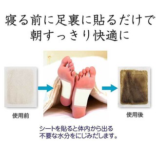 Miếng dán thải độc chân To-Plan Natural Foot Sheets 30 miếng