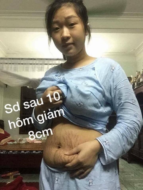 Kem tiêu mỡ trương gia hân