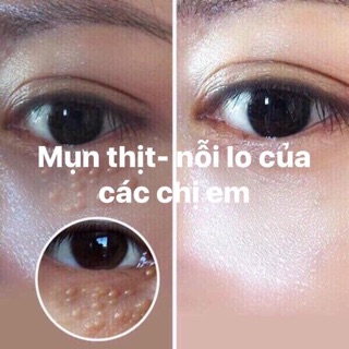 Kem mụn thịt Tsubuporon Nhật Bản