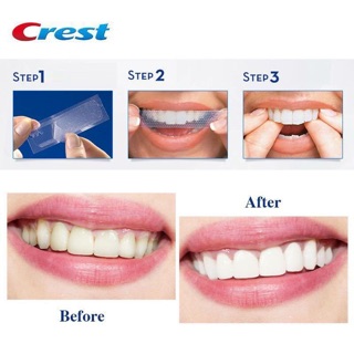 Miếng Dán Trắng Răng Crest 3D White Supreme FlexFit ( Miếng rời )