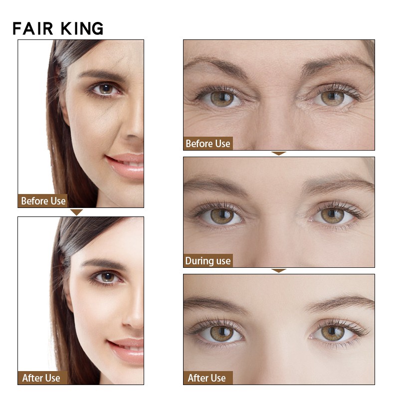 Serum FAIR KING dưỡng da chiết xuất Collagen Hyaluronic Acid làm trắng da chống lão hóa hiệu quả